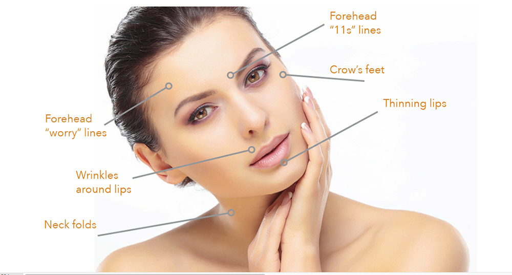 Cosmetic Acupuncture | Chiropractor in North Royalton, OH | Living Tree